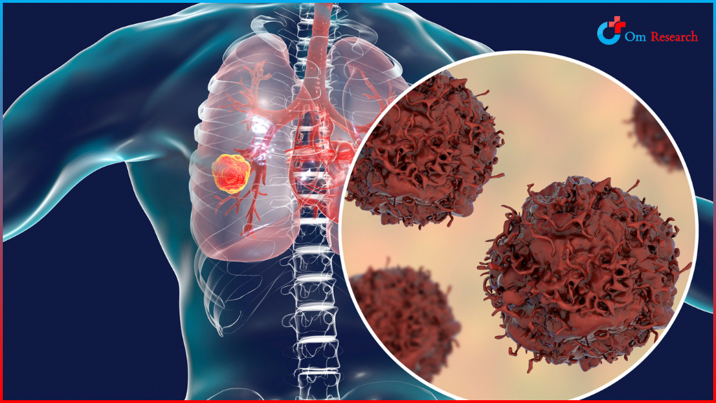 Lung cancer screening in Oxnard.