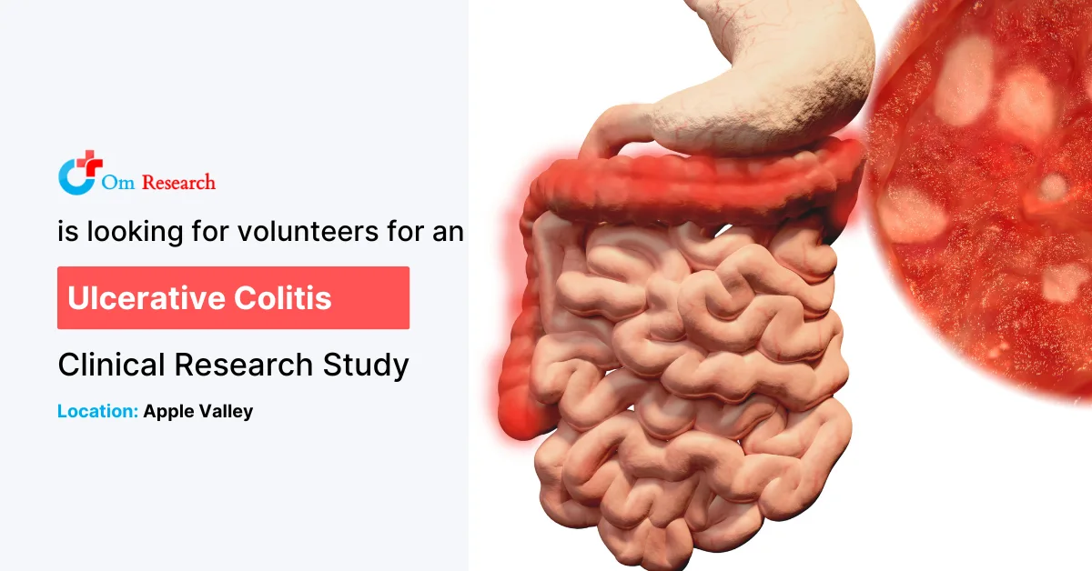 Ulcerative Colitis - Apple Valley