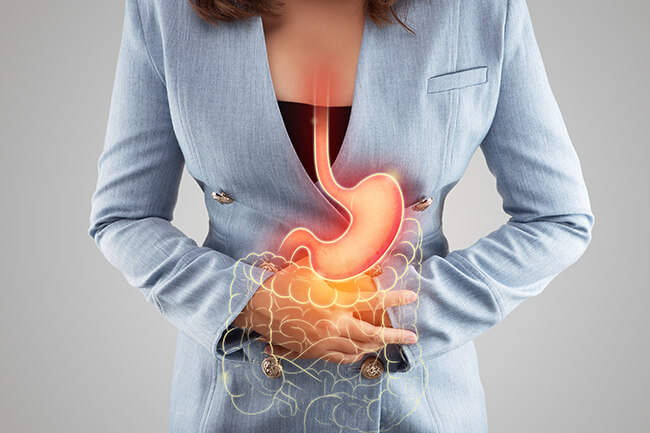 Heartburn and Acid Reflux